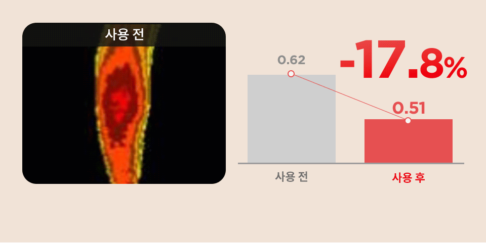 [콜마PICK/셀룰라이트 개선]아녹 위고슬림핏 아디포닌 펩타이드 괄사 슬리밍 바디로션 120ml | 올리브영 Detail