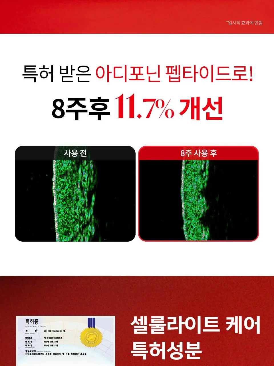 [콜마PICK/셀룰라이트 개선]아녹 위고슬림핏 아디포닌 펩타이드 괄사 슬리밍 바디로션 120ml | 올리브영 Detail