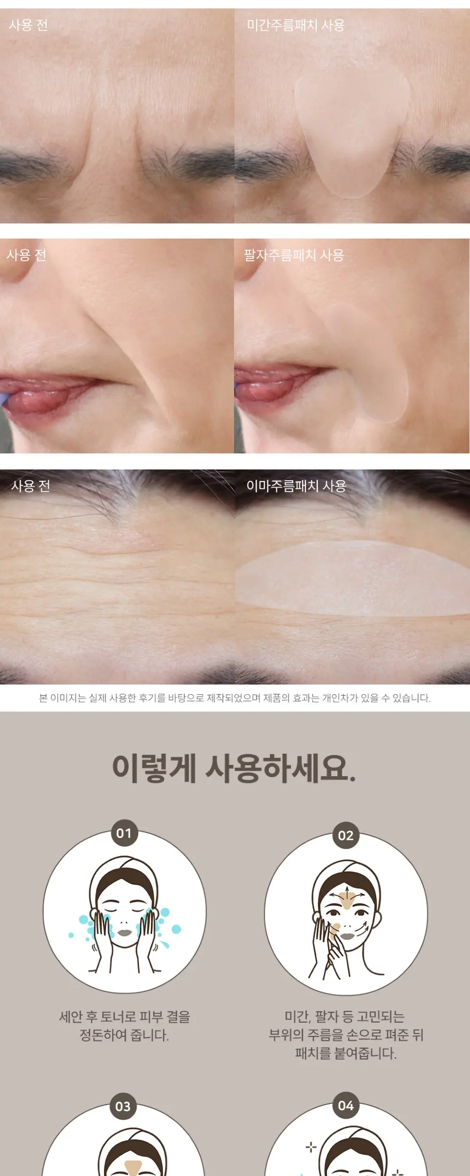 링클 리페어 미간주름 패치 Detail