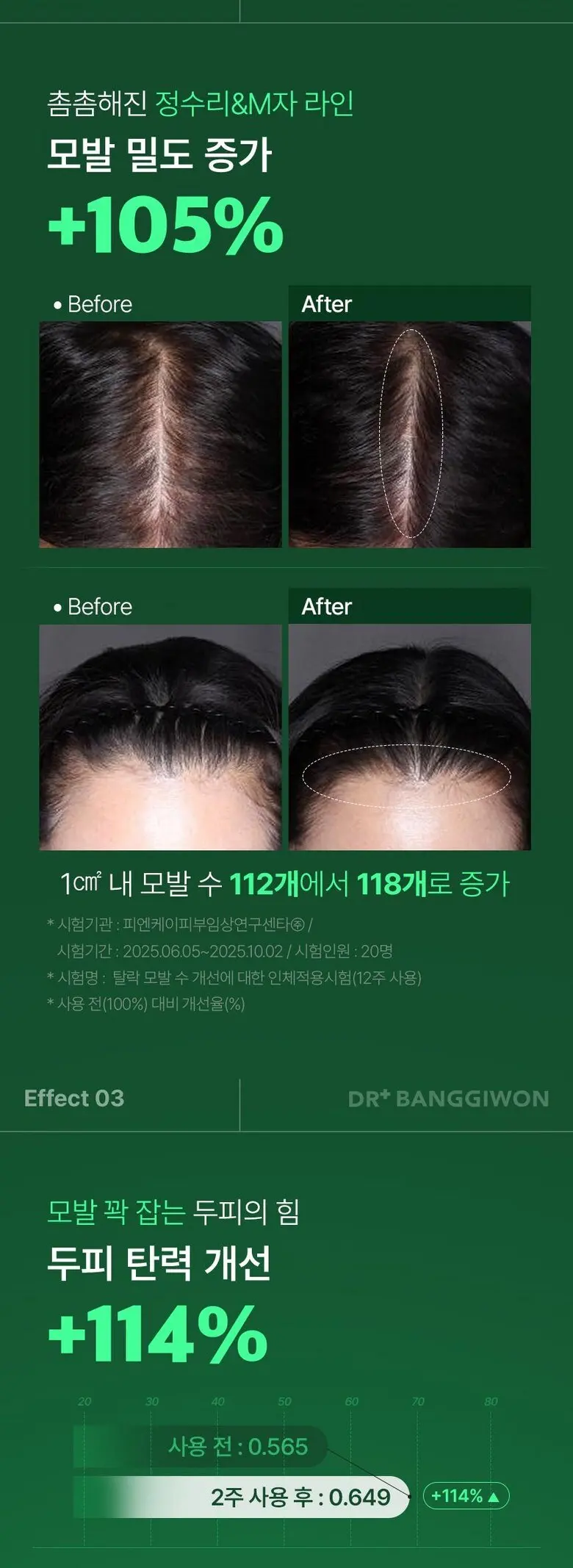 닥터방기원 국가기관임상완료 탈모특허 보리밥나무 바이오 기능성 탈모 샴푸, 1개, 1L Detail