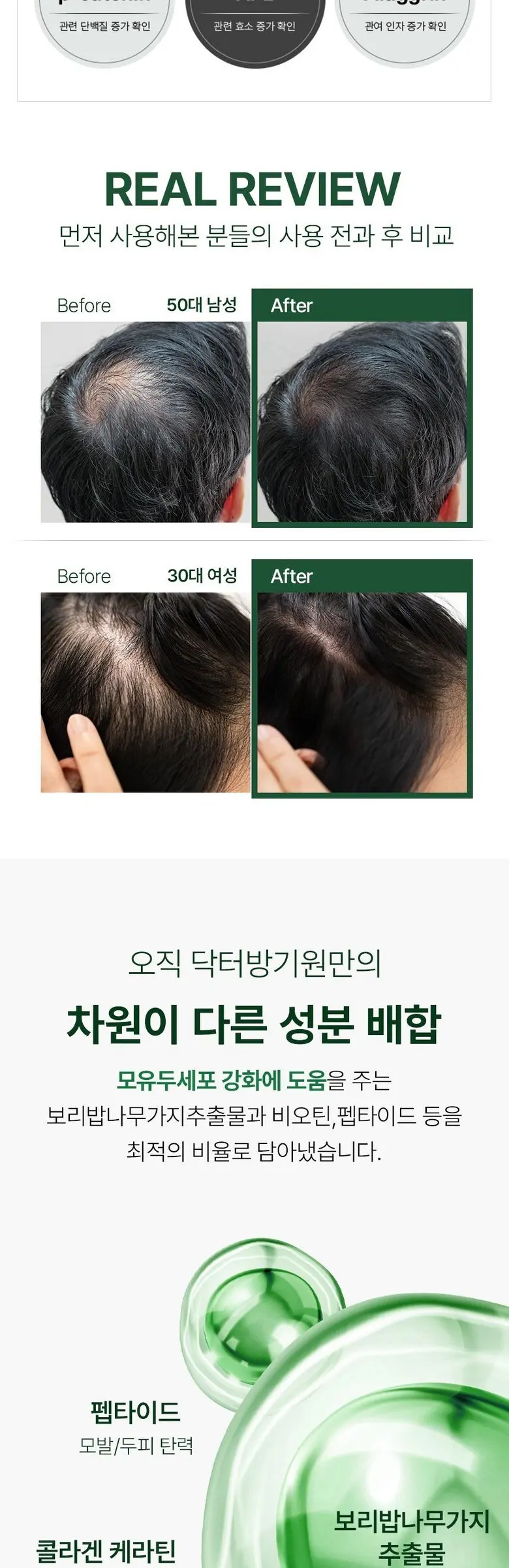 닥터방기원 국가기관임상완료 탈모특허 보리밥나무 바이오 기능성 탈모 샴푸, 1개, 1L Detail