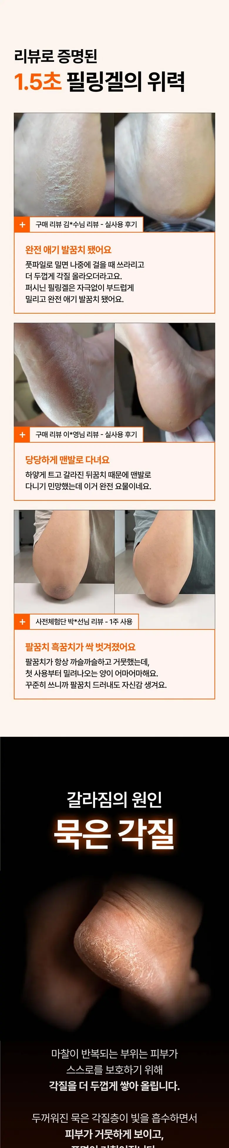 메디톨드 연구소 퍼시닌 다크존 필링겔 팔꿈치 무릎 각질제거 바디 스크럽 때필링 때비누 필링젤, 2개, 100ml Detail