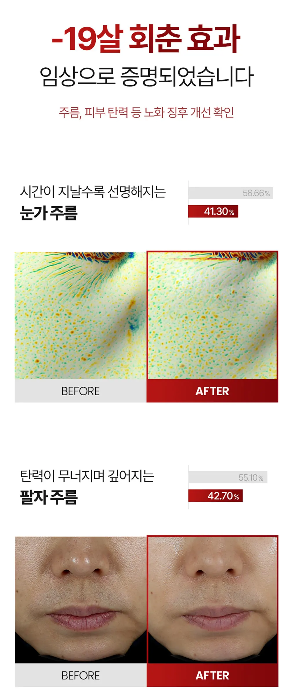 큐어토리 자가큘 줄기세포 주름앰플 탄력 리프팅 안티에이징 세럼 15ml Detail