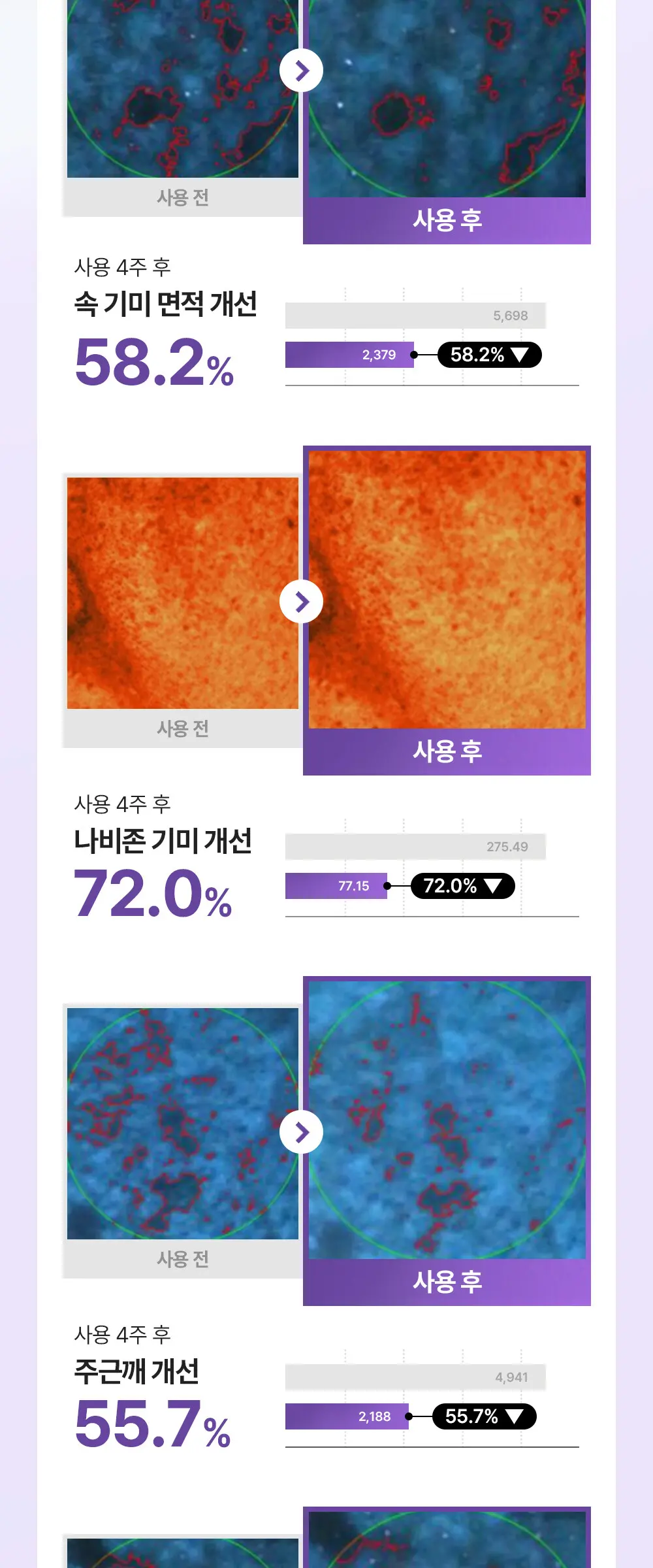 퍼플라이스 TXA 트라넥사믹애씨드 토닝 세럼 30ml Detail