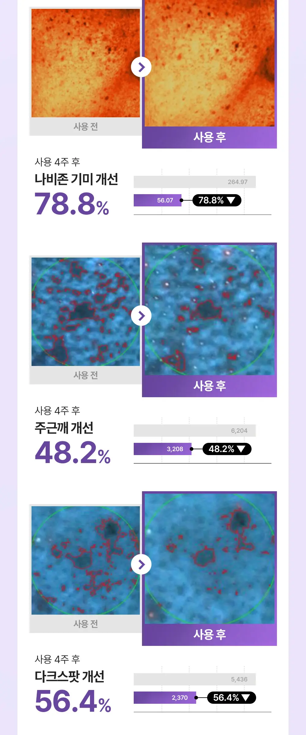 퍼플라이스 TXA 트라넥사믹애씨드 토닝 캡슐 크림 50ml Detail