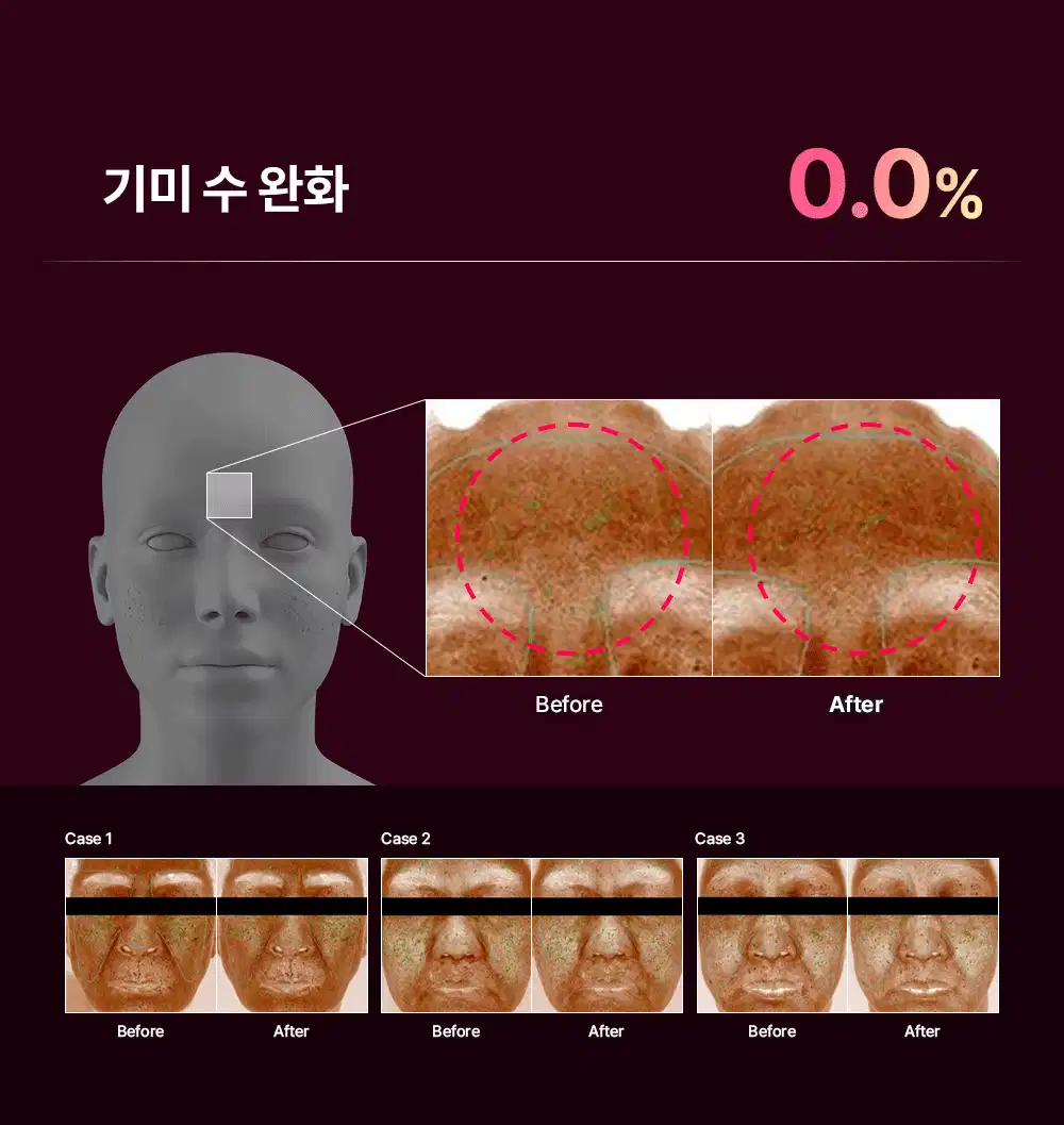 TXA5 트라넥삼산 액티브 브라이트닝 세럼 15ml Detail